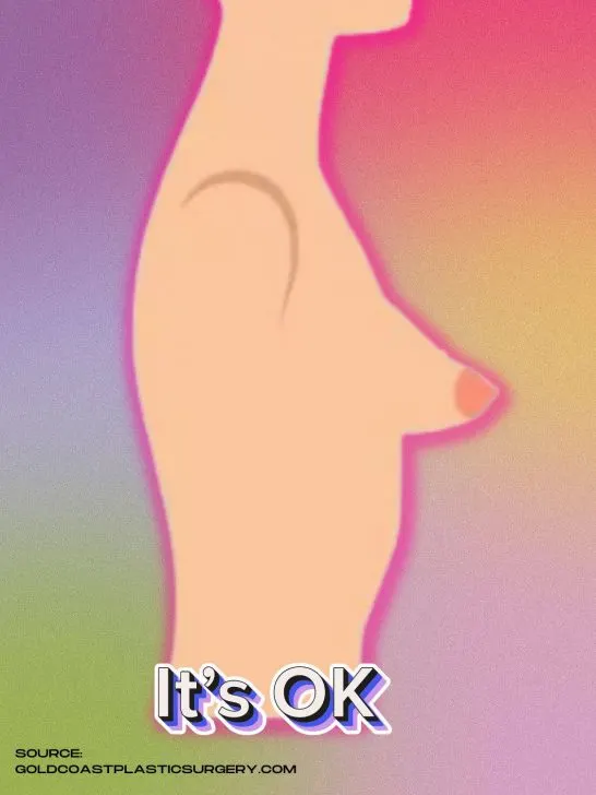 *2026* How to make the tubular breasts look normal? 7 styling tips to feel feminine!